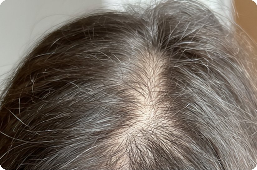 HairBooster+ Haargroei Serum