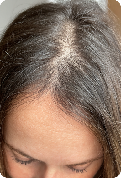 HairBooster+ Haargroei Serum